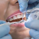 Dental exam with gloved hands and tools.