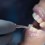Dental checkup with instrument