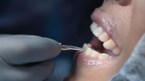 Dental checkup with instrument