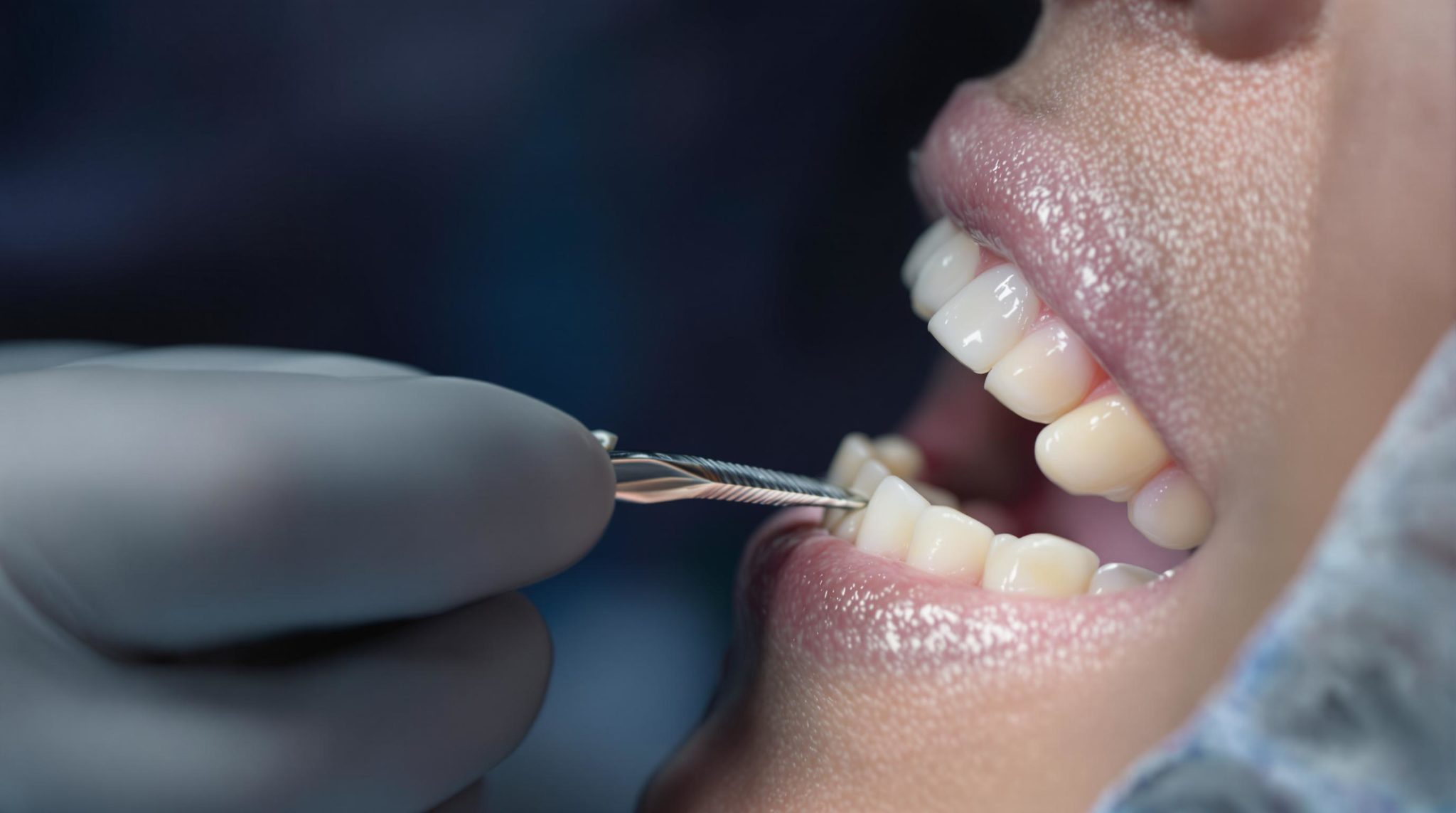 Dental checkup with instrument