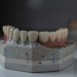 a close up of a tooth model on a table